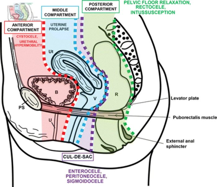 Female reproductive system midsagittal anatomy section anterior genital specialists ray